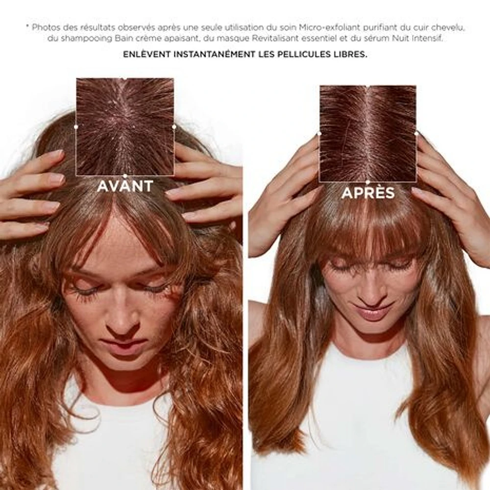 Symbiose | Routine for Medium to Thick Hair Prone to Dandruff