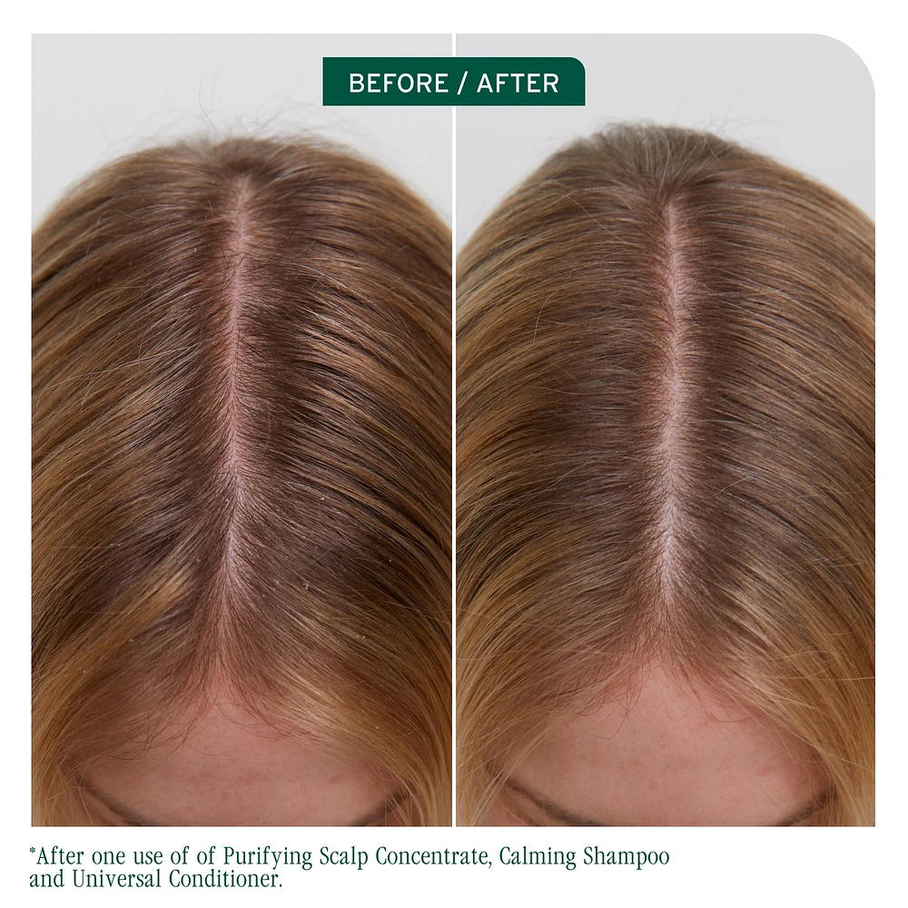 BIOLAGE Scalp Sync Calming Shampoo for Dry or Sensitive Scalp