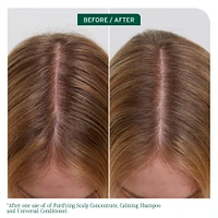 BIOLAGE Scalp Sync Calming Shampoo for Dry or Sensitive Scalp
