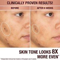 Dark Spot Correcting Radiance Recovery Serum