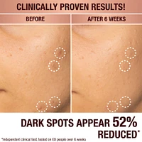 Dark Spot Correcting Radiance Recovery Serum