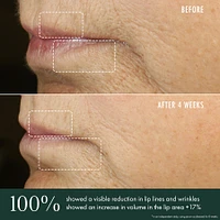 Advanced Lip Perioral Serum Targeted Vertical Line Filler