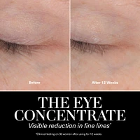 Eye Concentrate