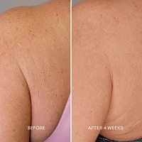 Body Repair Treatment 150 Ml