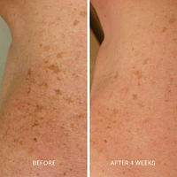 Body Repair Treatment 150 Ml
