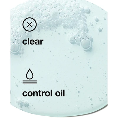 Acne Solutions Cleansing Gel