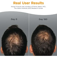 Viviscal Mens Supplement