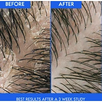 Fiji 2-in-1 Shampoo + Conditioner