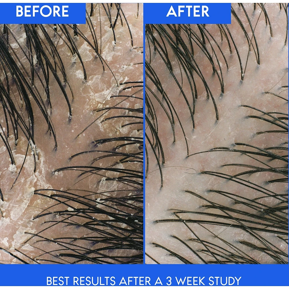 Deep Scalp Hydration Anti-Dandruff Shampoo