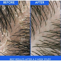 Deep Scalp Hydration Anti-Dandruff Shampoo