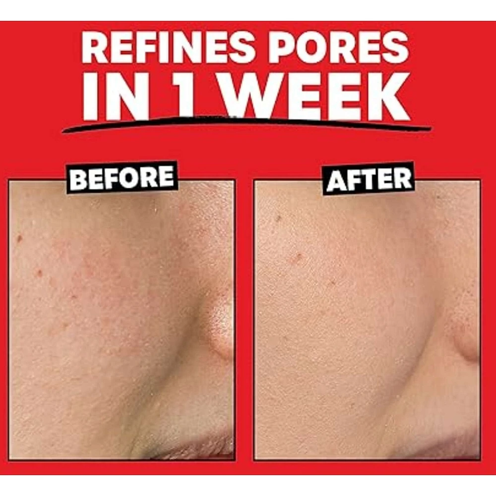 2% AHA Exfoliating Toner with Glycolic Acid, Lactic Acid and Witch Hazel, Smoothing and Pore Refining