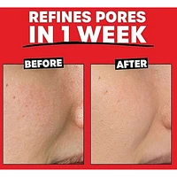 2% AHA Exfoliating Toner with Glycolic Acid, Lactic Acid and Witch Hazel, Smoothing and Pore Refining