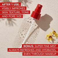 Rose Petal Alcohol-Free Witch Hazel Face Mist with Aloe Vera