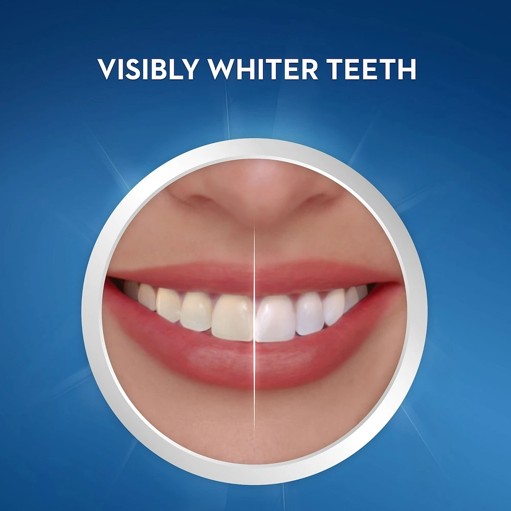 Crest 3D White Whitestrips Gentle Routine, 14 Treatments