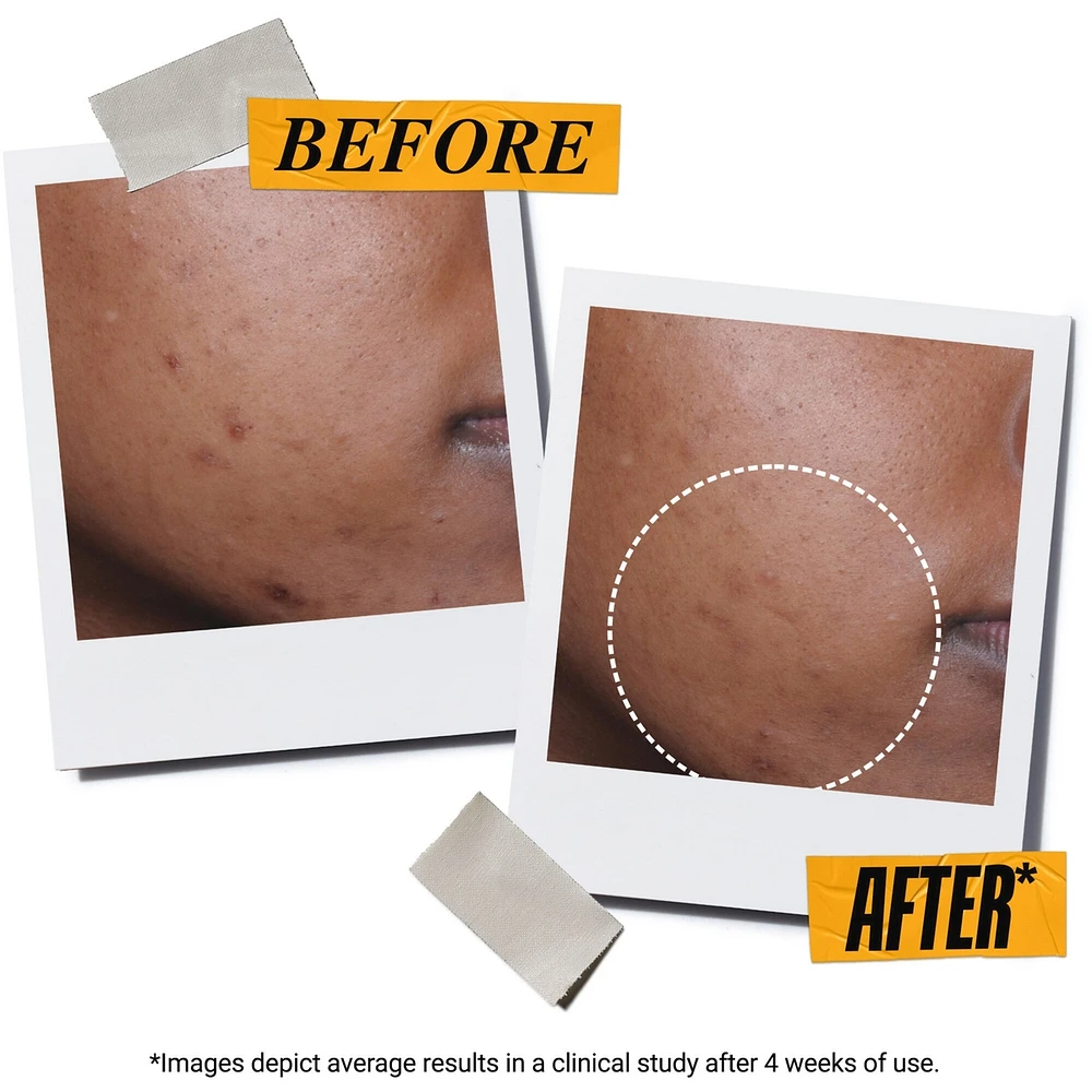 Beyond Screen® UV Serum SPF 50+ Facial Sunscreen with Collagen Peptide