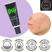Emergency Acne Vanishing Spot Gel Treatment with Salicylic Acid, For Inflamed Acne