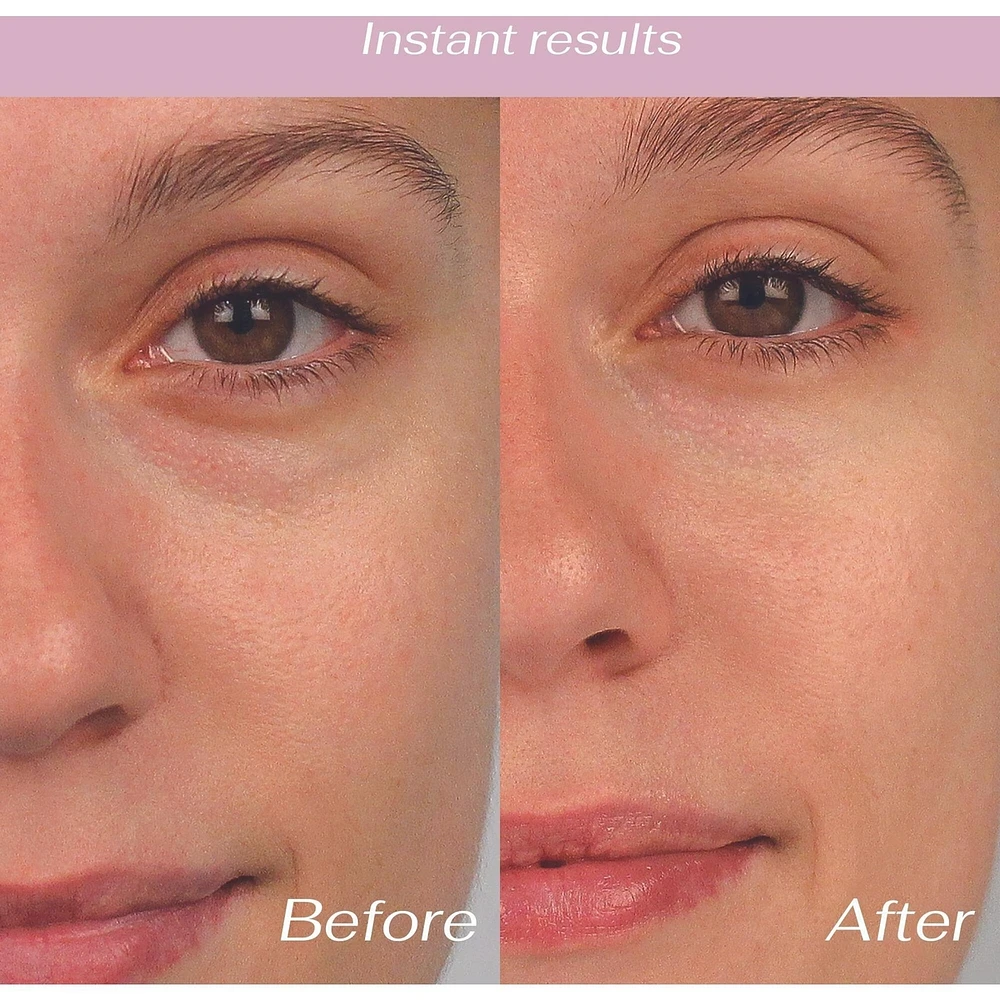 Bio Lift Eye Patch 6 Pairs