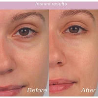 Bio Lift Eye Patch 6 Pairs