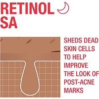Stubborn Marks PM Facial Treatment