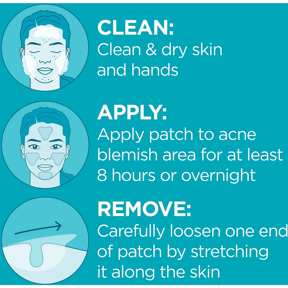 Hydro Seal Acne Blemish Patch - Hydrocolloid Pimple Patches, Face Pimple Spot Care