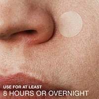 Stubborn Acne Blemish Patches, Hydrocolloid Spot Treatment, Pimple Care Patch, Duo Pack