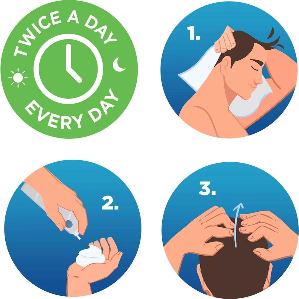 Men's 5% Minoxidil Foam Hair Loss and Thinning Treatment