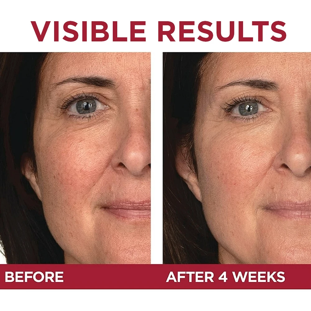 Retinol Eye Cream