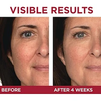 Retinol Eye Cream