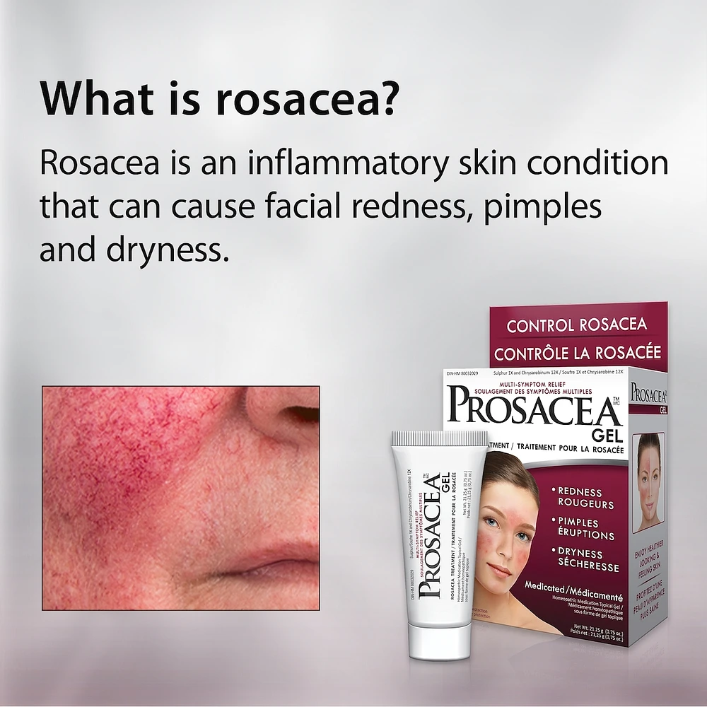 Rosacea Treatment Gel