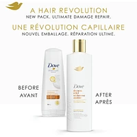 Dove Dryness & Itch Relief Conditioner for Dry and Itchy scalp,   with Liquid Bio-Protein Care technology 355 ML