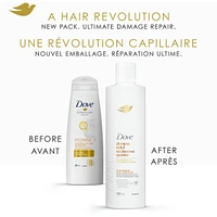 Dove Dryness & Itch Relief Shampoo for Dry and Itchy scalp,  with Liquid Bio-Protein Care technology, 355 ML