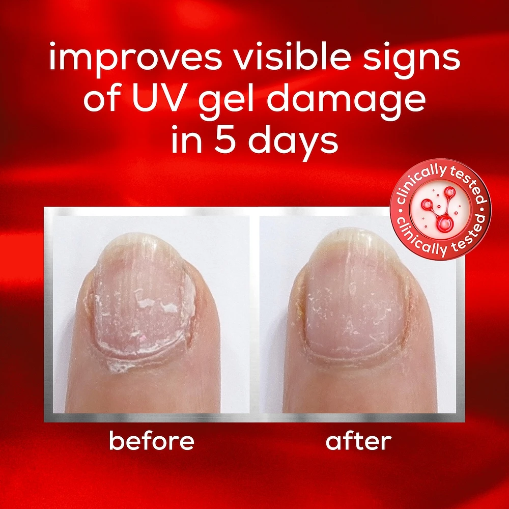 nail repair