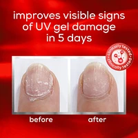 nail repair