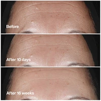 Smart Clinical Repair™ Serum