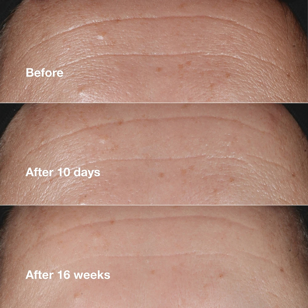 Clinique Smart Clinical Repair™ Wrinkle Correcting Serum