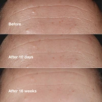 Clinique Smart Clinical Repair™ Wrinkle Correcting Serum