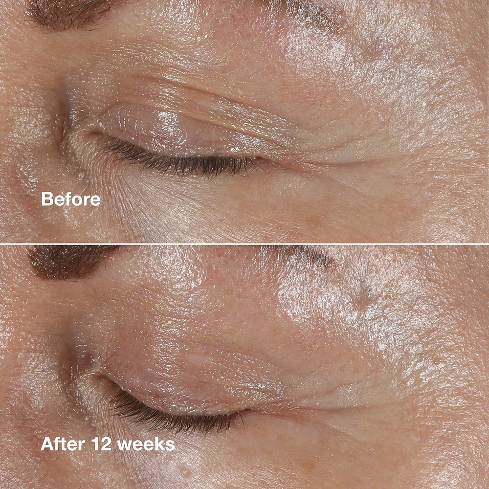 Smart Clinical Repair™ Wrinkle Correcting Eye Cream