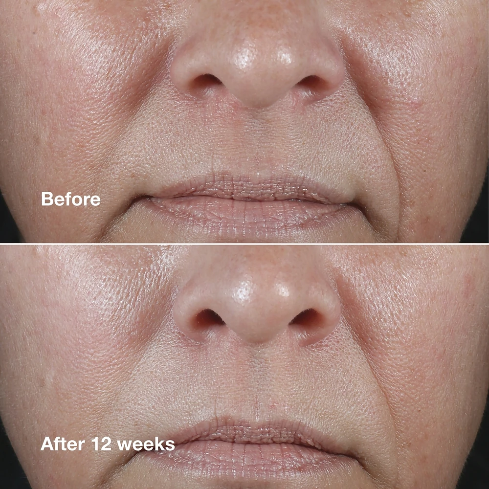 Smart Clinical Repair™ Wrinkle Correcting Rich Cream