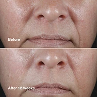 Smart Clinical Repair™ Wrinkle Correcting Rich Cream