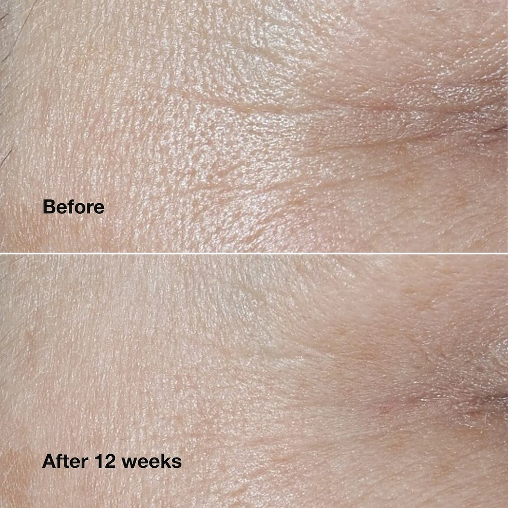 Smart Clinical Repair™ Wrinkle Correcting Cream