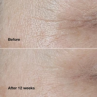 Smart Clinical Repair™ Wrinkle Correcting Cream