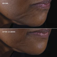 Clinique Smart Clinical Repair™ Lifting Face + Neck Cream