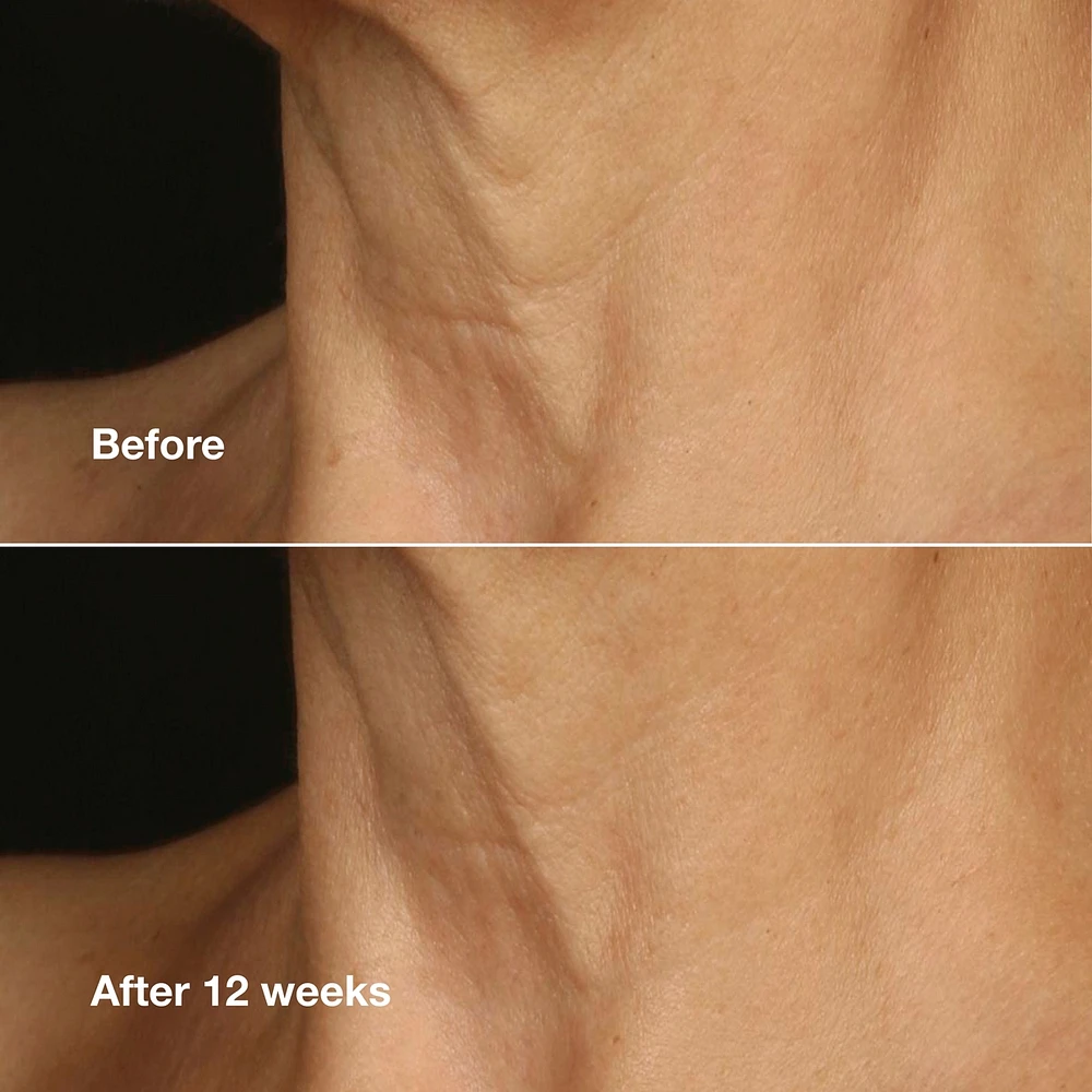 Clinique Smart Clinical Repair™ Lifting Face + Neck Cream