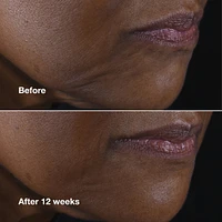 Clinique Smart Clinical Repair™ Lifting Face + Neck Cream