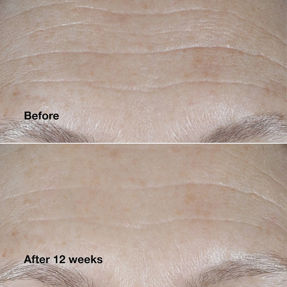 Clinique Smart SPF 30 Wrinkle Correcting Cream