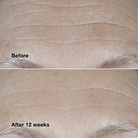 Clinique Smart SPF 30 Wrinkle Correcting Cream