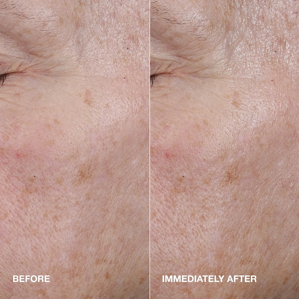 Moisture Surge™ Active Glow Serum