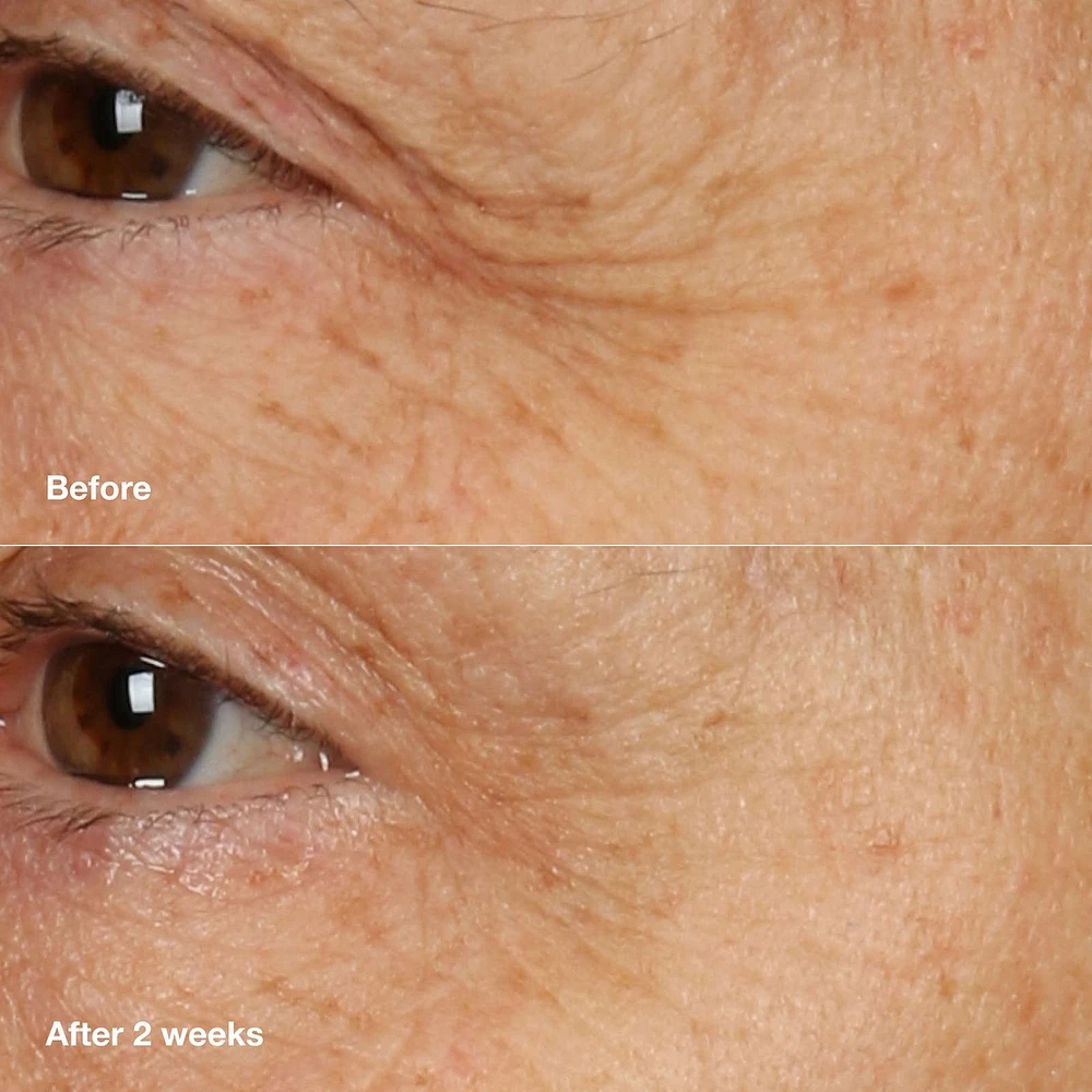 Clinique Smart Clinical Repair™ Overnight Recovery Cream + Mask
