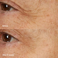 Clinique Smart Clinical Repair™ Overnight Recovery Cream + Mask