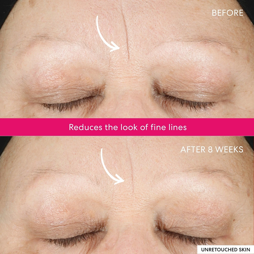 Ageless 10% Phyto-Lactic Radiance Facial